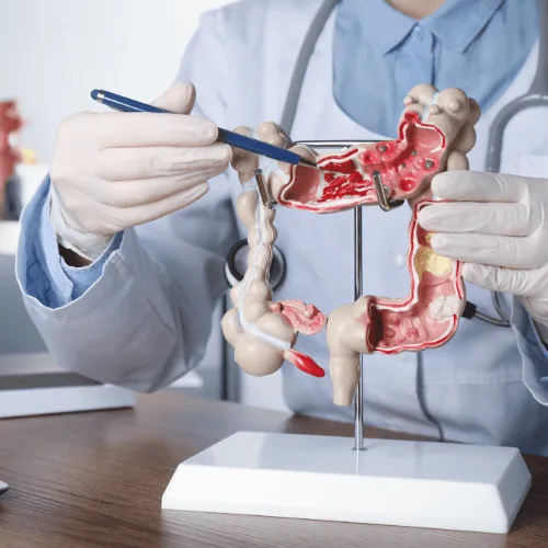 ¿Qué médico trata una hernia inguinal?