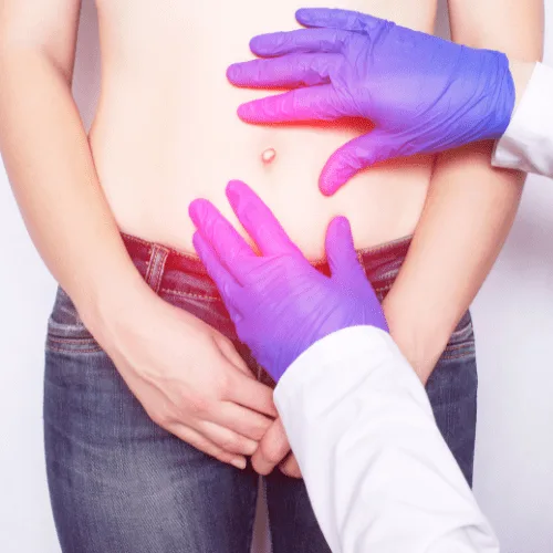 ¿Qué médico trata hernias abdominales?