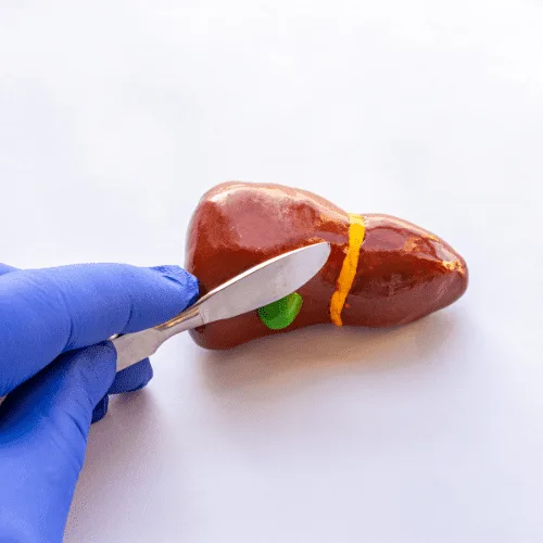 ¿Qué médico trata problemas gástricos quirúrgicos?